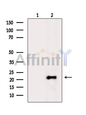Валидация Affinity DF14456 - 10429