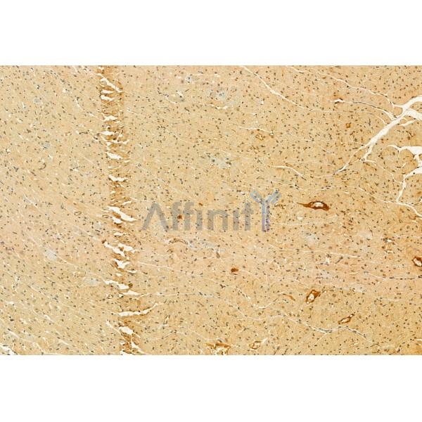 Валидация Affinity DF12112 - 6246