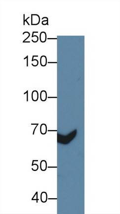 10142