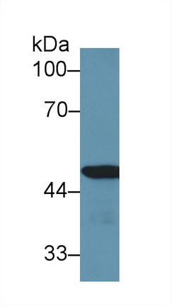 13456