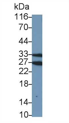 17670