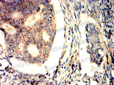 Валидация AntibodySystem RHD03801 (1293)