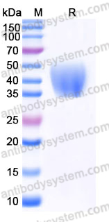 EHJ76301, SDS-PAGE