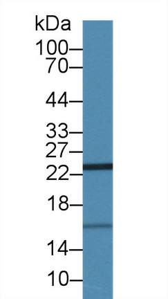 14401