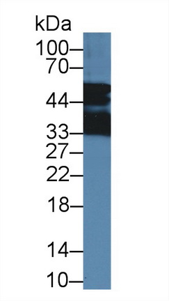 14385