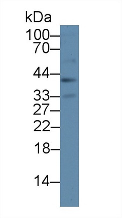 62695