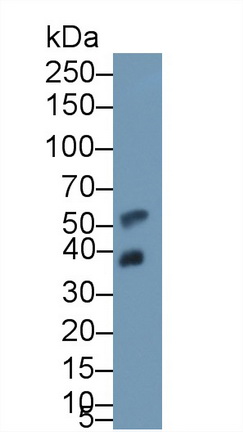 12349