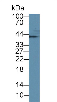 14120