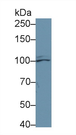 14651