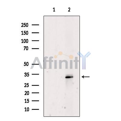 Валидация Affinity DF8984 - 21179