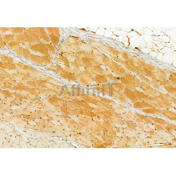Валидация Affinity DF12014 - 6023
