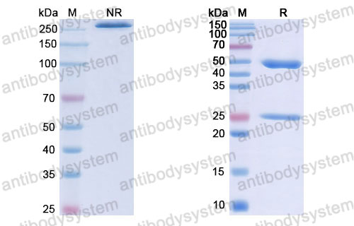 Валидация SDS-PAGE - AntibodySystem RHJ92810