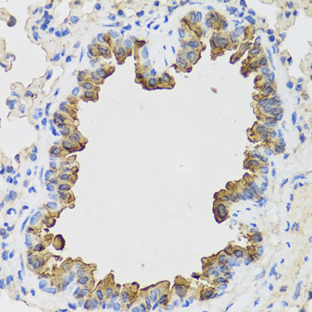 A7973, иммуногистохимия, парафиновые срезы легкого мыши (24127)