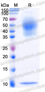 AHD14203, SDS-PAGE