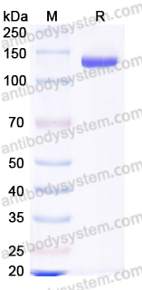 EHG01303, SDS-PAGE