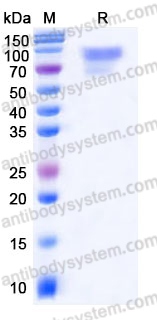 EHE04902, SDS-PAGE