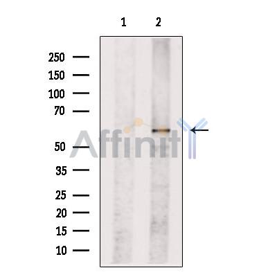 Валидация Affinity DF13443 - 8772
