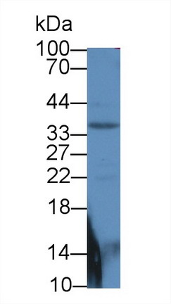 9015