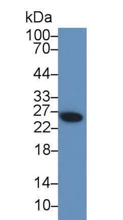 17592