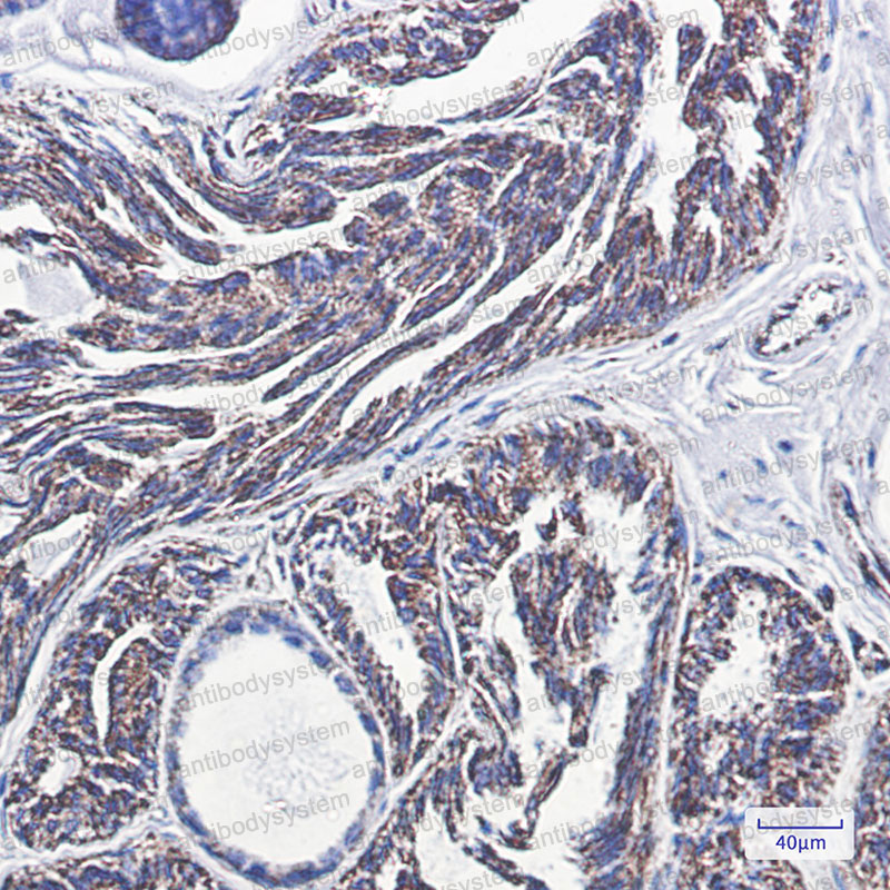 Валидация AntibodySystem RHN81301