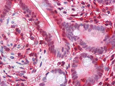 Валидация AntibodySystem RHN89202