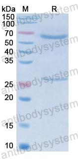 Валидация SDS-PAGE - AntibodySystem FMJ93250