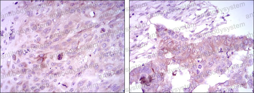 Валидация AntibodySystem RHN92402