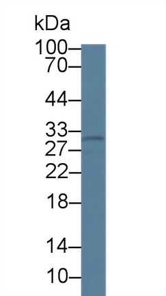 14173