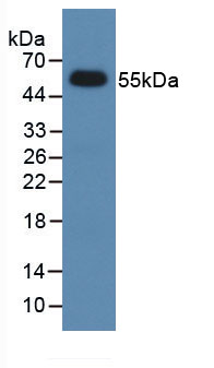 15000