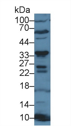 14729