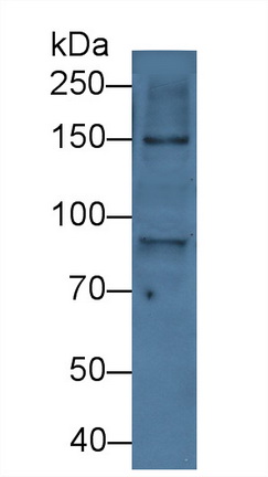 13961