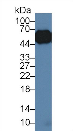 10174