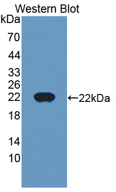 53217