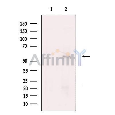 Валидация Affinity DF13544 - 8974