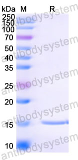 Валидация SDS-PAGE - AntibodySystem RVV08905