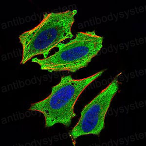 Валидация IF - AntibodySystem RHN93701