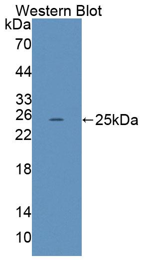 41254