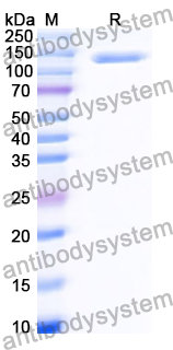 YHD57902, SDS-PAGE