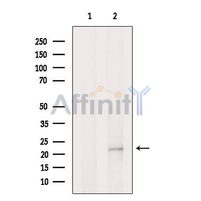 Валидация Affinity DF13293 - 8421