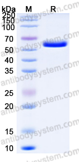 EHC01201, SDS-PAGE