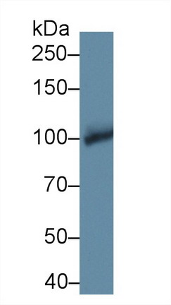 10000