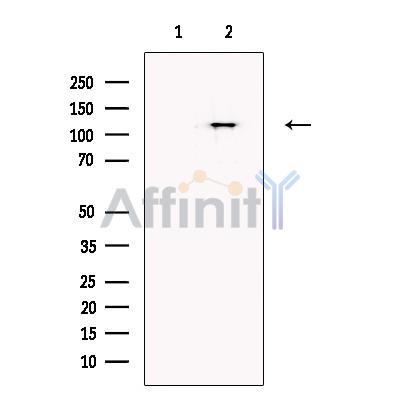 Валидация Affinity DF13662 - 9227
