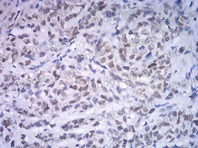 Валидация AntibodySystem RHD31103 (1466)