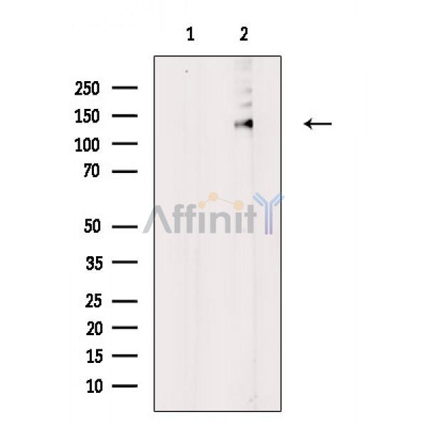 Валидация Affinity AF6874 - 4088