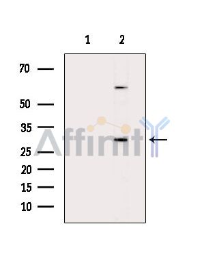 Валидация Affinity DF14315 - 10209