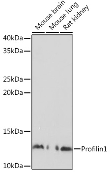 A1164, вестерн-блоттинг, различные лизаты (3997)