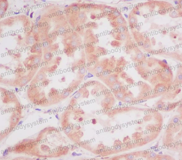 Валидация AntibodySystem RHF38002