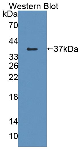 59085