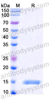 Валидация SDS-PAGE - AntibodySystem RVV14301