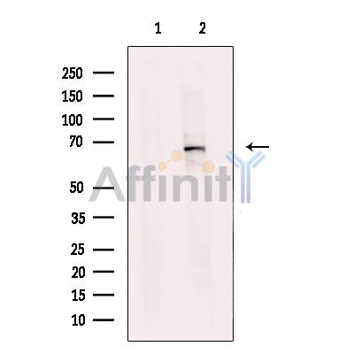 Валидация Affinity DF13611 - 9117